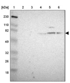 Lane 1: Marker [kDa] 230, 110, 82, 49, 32, 26, 18_br/_Lane 2: Human cell line RT-4_br/_Lane 3: Human cell line U-251MG sp_br/_Lane 4: Human plasma (IgG/HSA depleted)_br/_Lane 5: Human liver tissue_br/_Lane 6: Human tonsil tissue