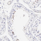 Anti-ACTRT1 Antibody