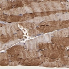 Immunohistochemical staining of human skeletal muscle shows strong cytoplasmic positivity in myocytes.