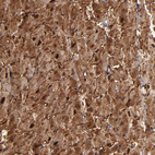 Immunohistochemical staining of human heart muscle shows strong cytoplasmic positivity in cardiomyocytes.