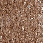Immunohistochemical staining of human heart muscle shows strong cytoplasmic positivity in cardiomyocytes.