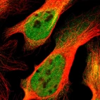Immunofluorescent staining of human cell line U-2 OS shows localization to nucleoplasm & cytosol.