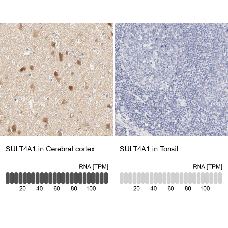Anti-SULT4A1 Antibody