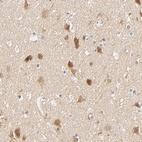 Immunohistochemical staining of human cerebral cortex shows high expression.