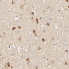 Immunohistochemical staining of human cerebral cortex shows high expression.