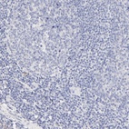Anti-SULT4A1 Antibody