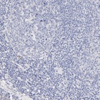 Immunohistochemical staining of human tonsil shows low expression as expected.