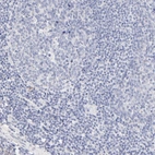 Immunohistochemical staining of human tonsil shows low expression as expected.