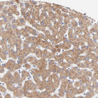 Anti-EBP Antibody