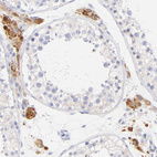 Anti-EBP Antibody