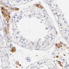 Immunohistochemical staining of human testis shows strong granular cytoplasmic positivity in Leydig cells.