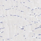 Immunohistochemical staining of human skeletal muscle shows no positivity in myocytes as expected.
