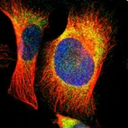 Immunofluorescent staining of human cell line U-251 MG shows localization to endoplasmic reticulum.