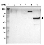 Anti-ZAP70 Antibody