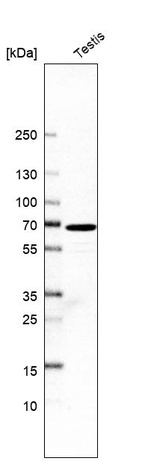 Anti-BBOF1 Antibody