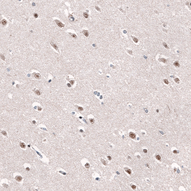 Anti-AFF2 Antibody