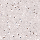 Anti-AFF2 Antibody