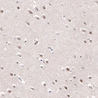 Anti-AFF2 Antibody