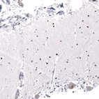Immunohistochemical staining of human cerebellum shows strong nuclear positivity in cells in molecular layer.