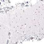 Immunohistochemical staining of human cerebellum shows strong nuclear positivity in cells in molecular layer.
