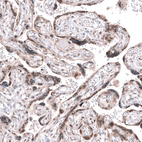 Immunohistochemical staining of human placenta shows moderate nuclear and cytoplasmic positivity in trophoblastic cells.