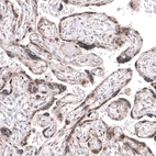 Immunohistochemical staining of human placenta shows moderate nuclear and cytoplasmic positivity in trophoblastic cells.