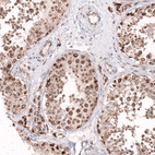 Immunohistochemical staining of human testis shows moderate nuclear positivity in cells in seminiferous ducts.