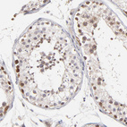 Anti-ZNF177 Antibody