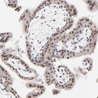 Immunohistochemical staining of human placenta shows strong nuclear positivity in trophoblastic cells.