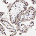 Anti-ZNF177 Antibody