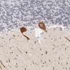 Immunohistochemical staining of human cerebellum shows strong cytoplasmic positivity in Purkinje cells.