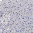 Immunohistochemical staining of human pancreas shows no positivity in exocrine glandular cells as expected.