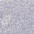 Anti-ZNF177 Antibody