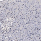 Immunohistochemical staining of human pancreas shows no positivity in exocrine glandular cells as expected.