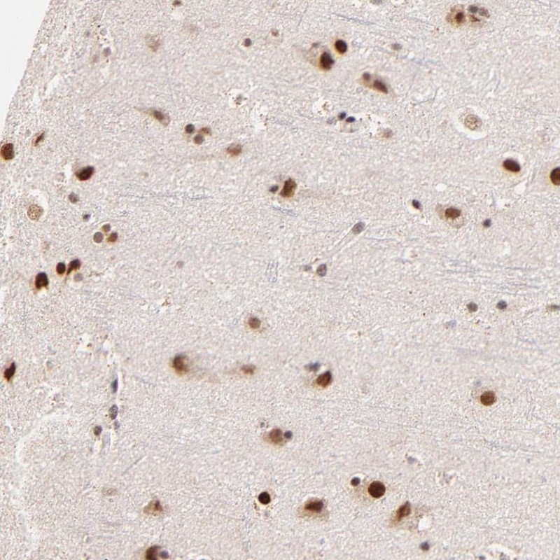 Anti-ZNF670 Antibody