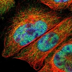 Immunofluorescent staining of human cell line A-431 shows positivity in cytoplasm, mitochondria & nucleus but excluded from the nucleoli.