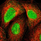 Immunofluorescent staining of human cell line A-431 shows localization to nucleoplasm.