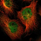Immunofluorescent staining of human cell line U-251 MG shows localization to nucleoplasm & microtubules.
