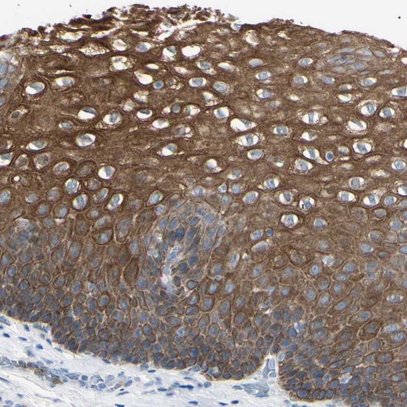 Anti-ZNF558 Antibody