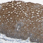 Anti-ZNF558 Antibody