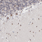 Anti-ZNF773 Antibody