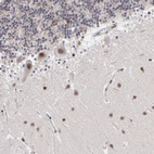 Anti-ZNF773 Antibody