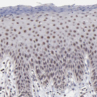 Immunohistochemical staining of human skin shows strong nuclear positivity in squamous epithelial cells.