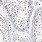 Immunohistochemical staining of human testis shows moderate nuclear positivity in a subset of cells in seminiferous ducts.