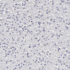 Anti-ZNF773 Antibody