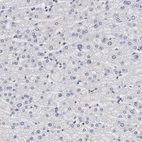 Immunohistochemical staining of human liver shows no positivity as expected.