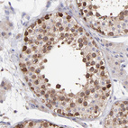 Anti-NSF Antibody