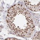 Immunohistochemical staining of human testis shows moderate to strong cytoplasmic positivity in cells in seminiferous ducts.