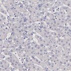Immunohistochemical staining of human liver shows no positivity in hepatocytes as expected.