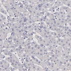 Immunohistochemical staining of human liver shows no positivity in hepatocytes as expected.